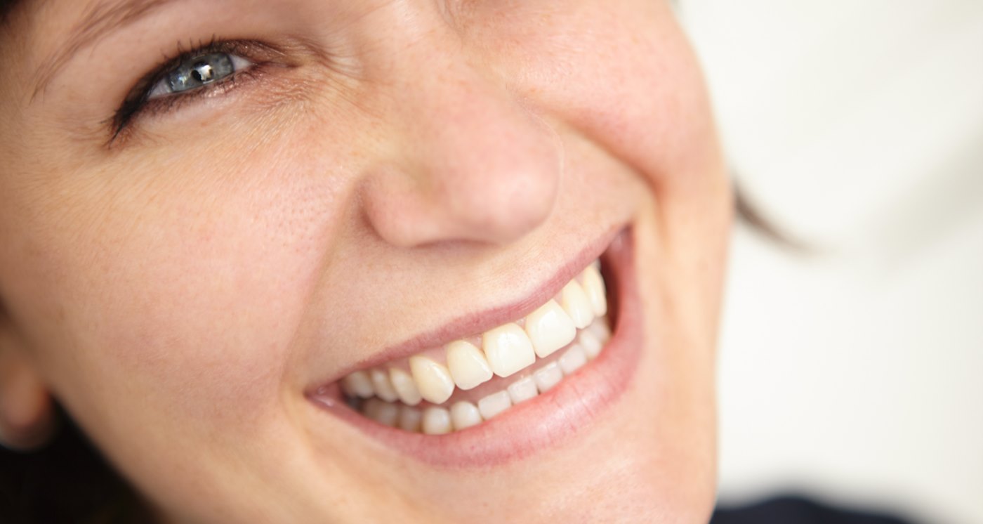 Minimalinvasive und ästhetische Füllungstherapie – Zahnerhalt für ein makelloses Lächeln! - Zahnarzt Wetzlar