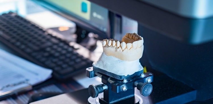 Hochwertiger Zahnersatz in kürzester Zeit – dank CEREC in Wetzlar bei Zahnarzt Dr. Röder und Kollegen