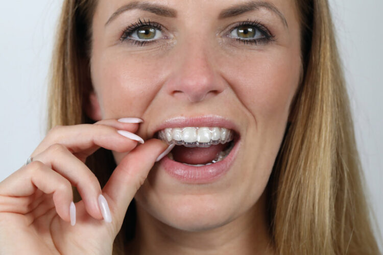 Gerade Zähne mit Clear Aligner® in Wetzlar im Zahnzentrum Dr. Roeder und Kollegen - Unsichtbare Zahnkorrektur mit transparenten Zahnspangen