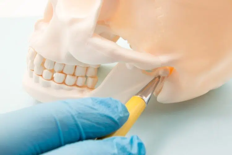 Kiefergelenksbeschwerden infolge von Zahnverlust - Zahnarzt Wetzlar